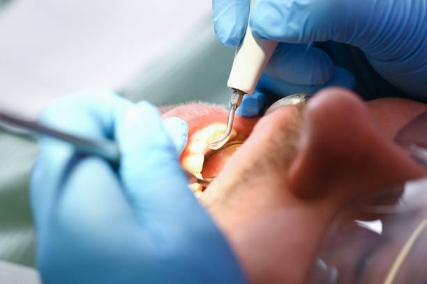 Best Chipped Tooth Repair Near Me  in Pleasantville, IA